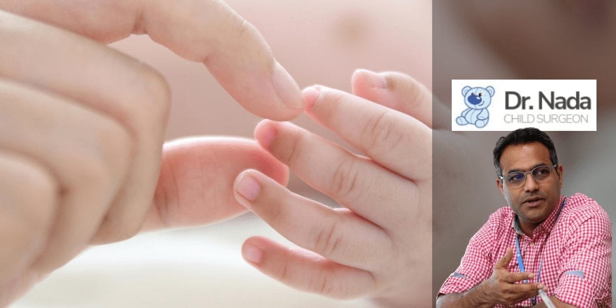 You are currently viewing Circumcision – is it necessary or beneficial for boys in Malaysia?