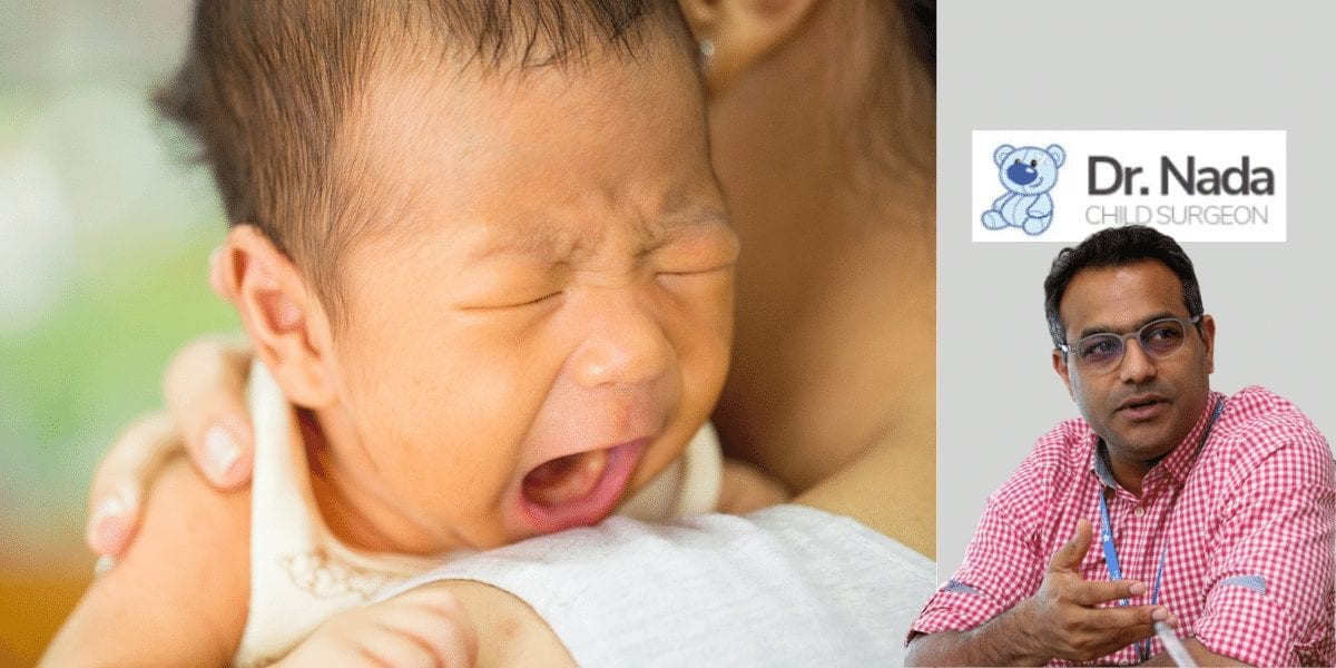 Read more about the article What is Tongue Tie in babies & children – causes, symptoms & treatment in Malaysia