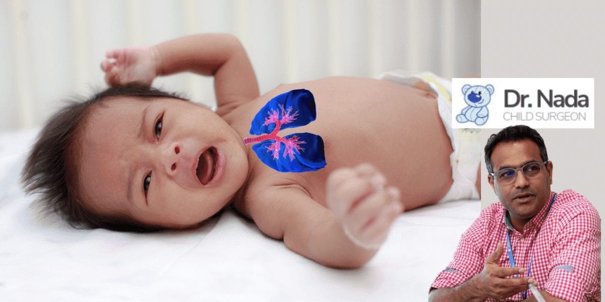 Read more about the article What is Lung Malformation in children –  causes, symptoms & treatment in Malaysia