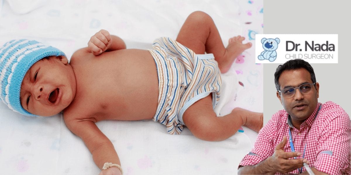 Read more about the article What are Choledochal Cysts in children – causes, symptoms & treatment in Malaysia