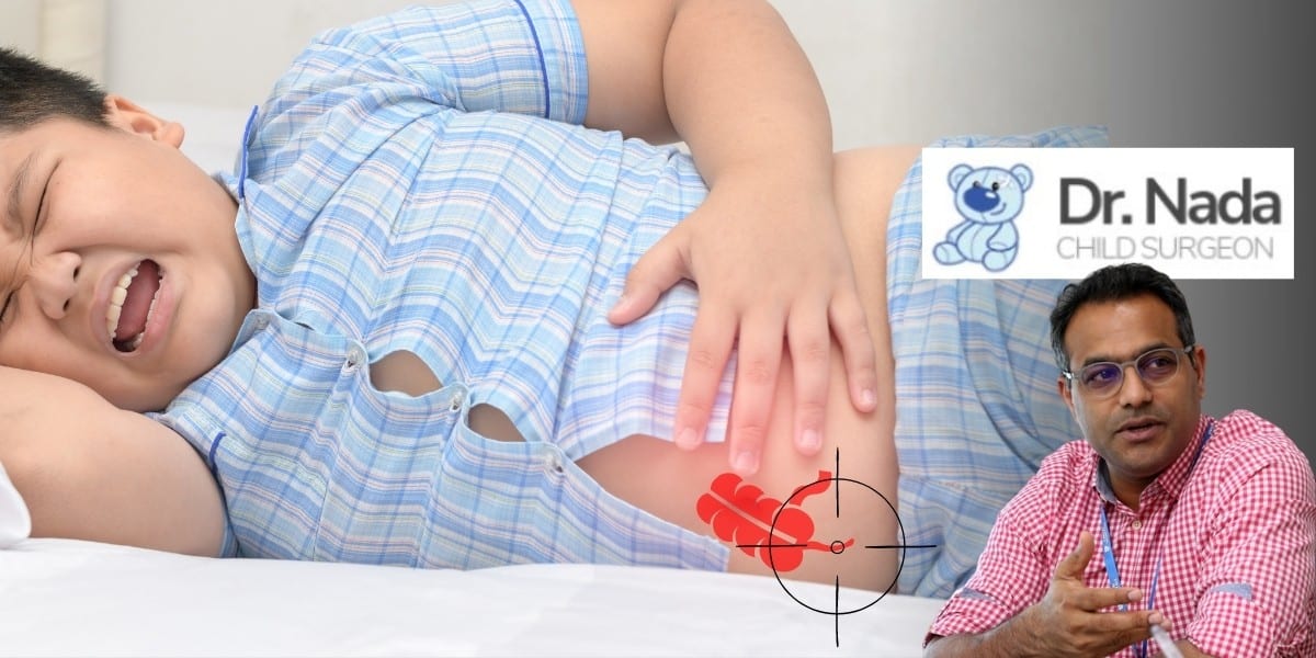 You are currently viewing Appendicitis in children – what is it and how it can be treated in Malaysia