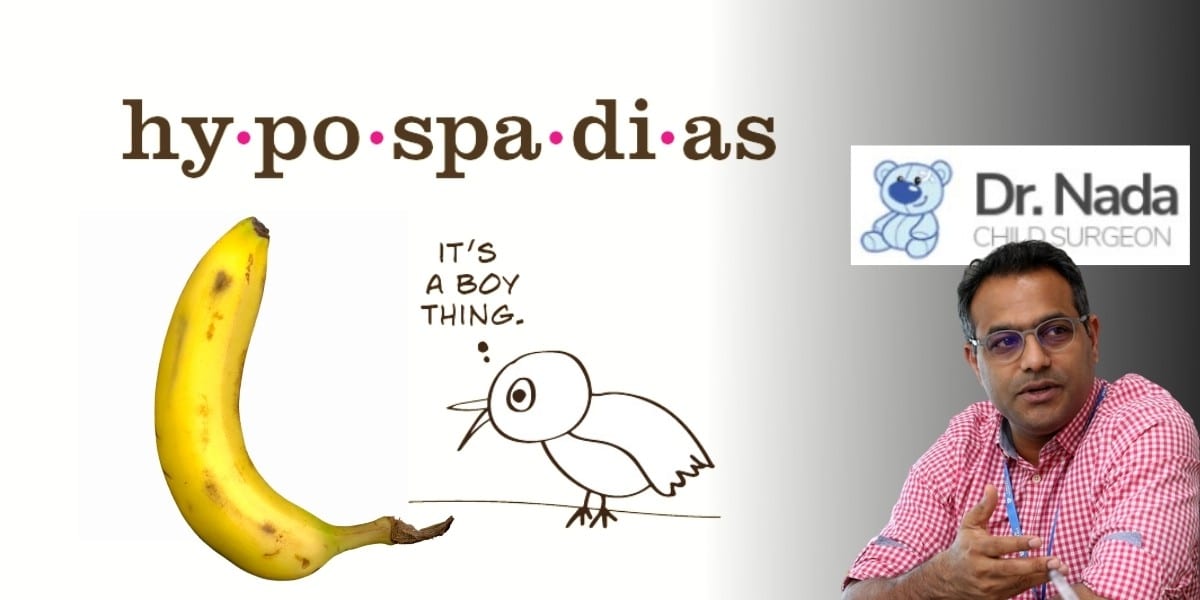 Read more about the article What is Hypospadias and how it can be treated in Malaysia