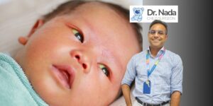 Read more about the article Choledochal Cysts – Why Paediatric Laparoscopic Surgery Is Preferred