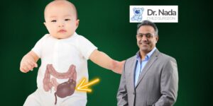 Read more about the article Hirschsprungs Disease – Why Paediatric Laparoscopic Surgery Is Preferred